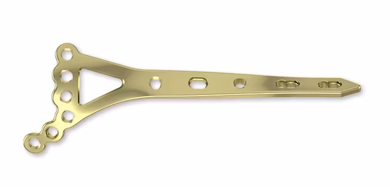 Femur-Verriegelungsplatte, medizinische Titanplatten, chirurgische Implantate, Verriegelungsplatte, medizinische Ausrüstung